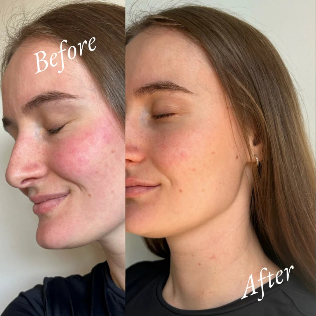 Her Serum  Face~Body~Bump