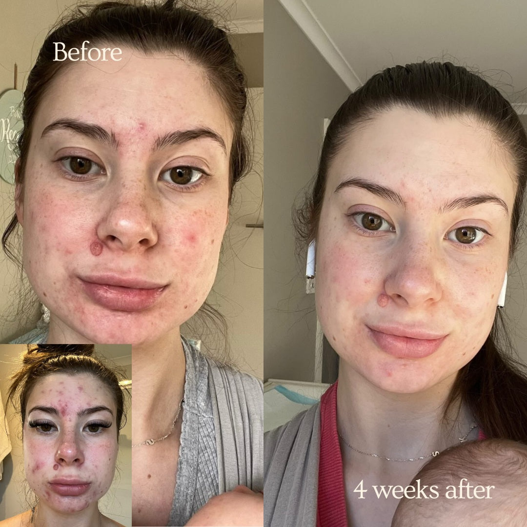 Her Serum  Face~Body~Bump