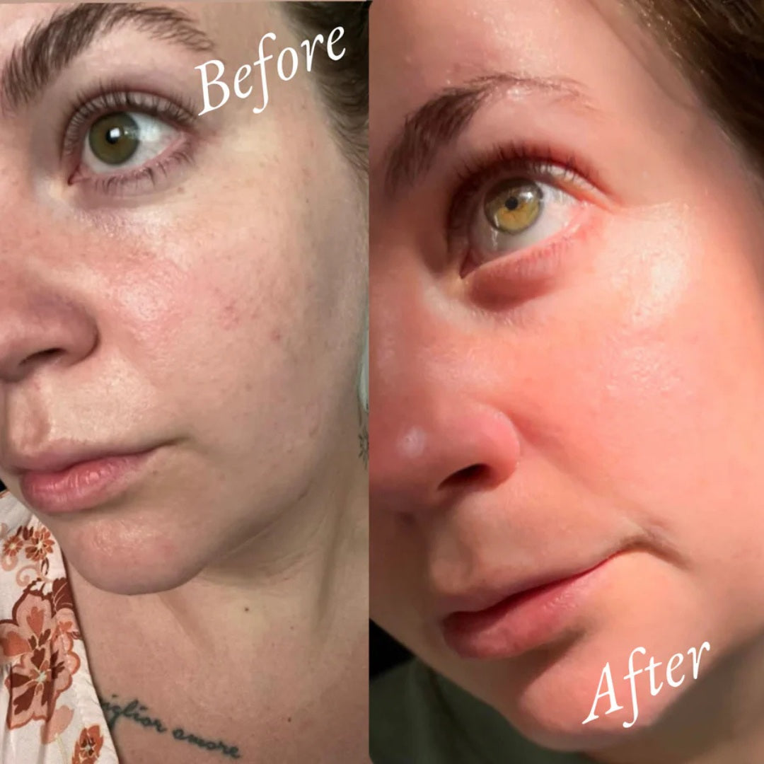 Her Serum  Face~Body~Bump